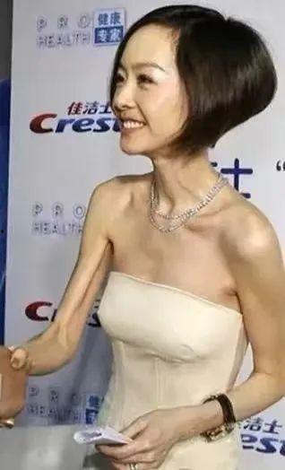 明星是如何快速暴瘦的,揭秘快速瘦身之道